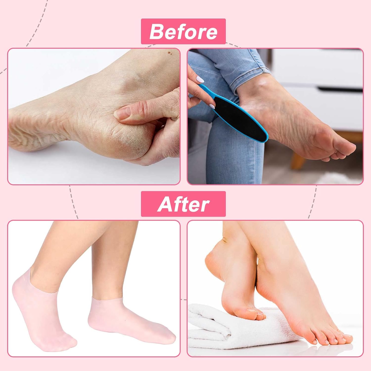 Silicone Gel Socks (1 Pair)